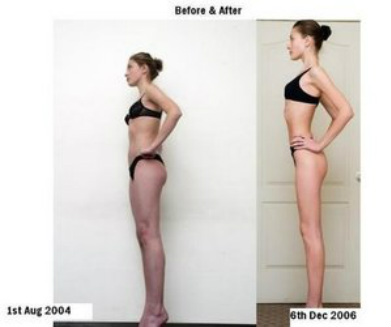 pro ana before and after 52