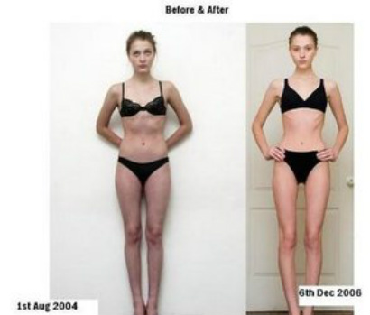 pro ana before and after 52